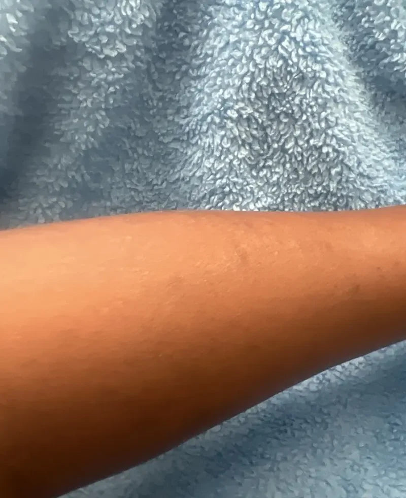 After comparison photo