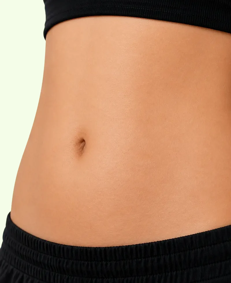 After comparison photo